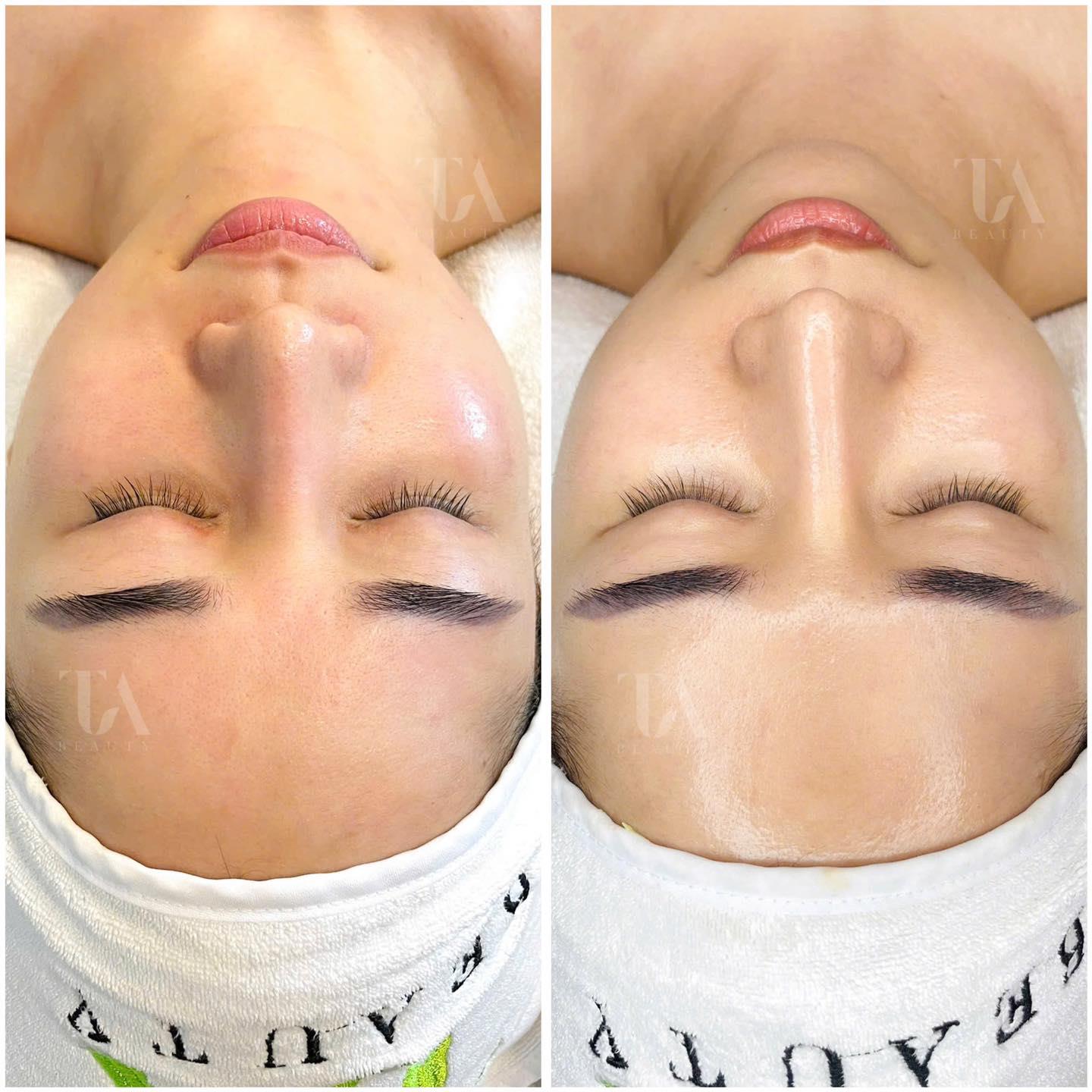 Pure Bright Cocktail Peel